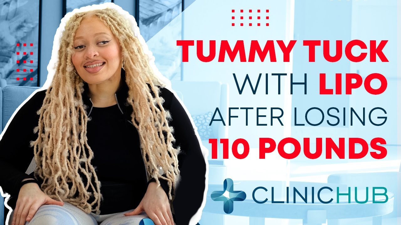 Clinichub | TUMMY TUCK AFTER LOSING 110 POUNDS