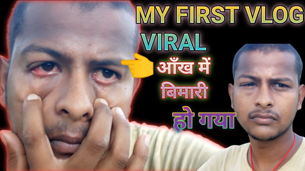 my first vlog viral | आँख में बिमारी हो गया | Ramod vlog | my first vlog 2023 | my first vlog today