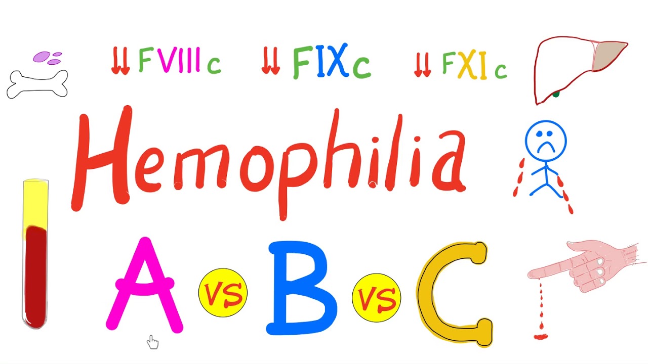 Hemophilia Types - hemophilia A, Hemophilia B, and Hemophilia C - Comparison - Genetics, Hematology