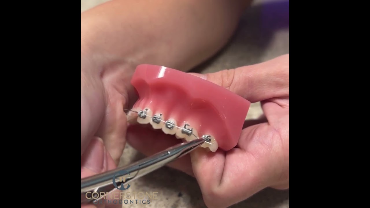 HOW TO FIX A WIRE THAT IS OUT OF YOUR BACK BRACKET