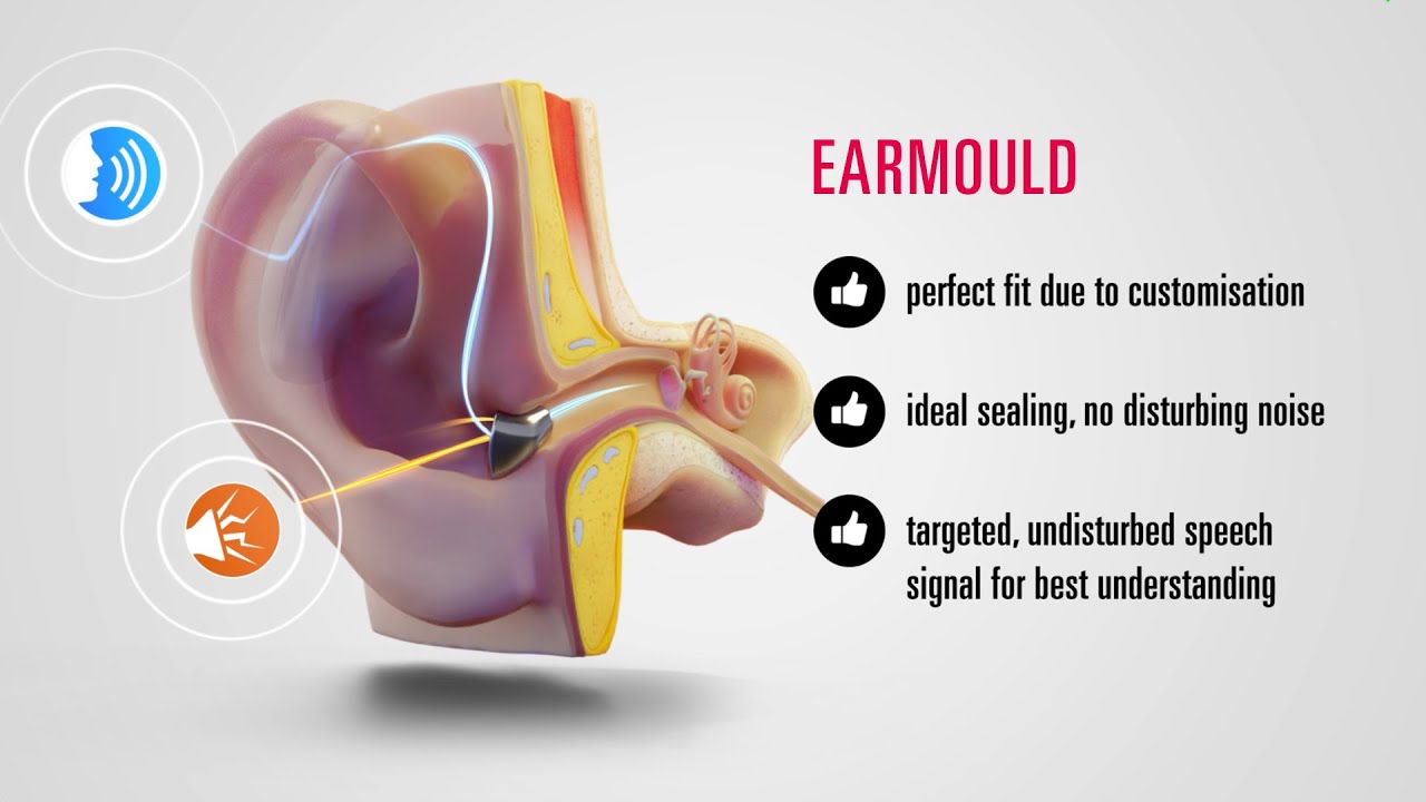 This is how an earmould helps to understand better