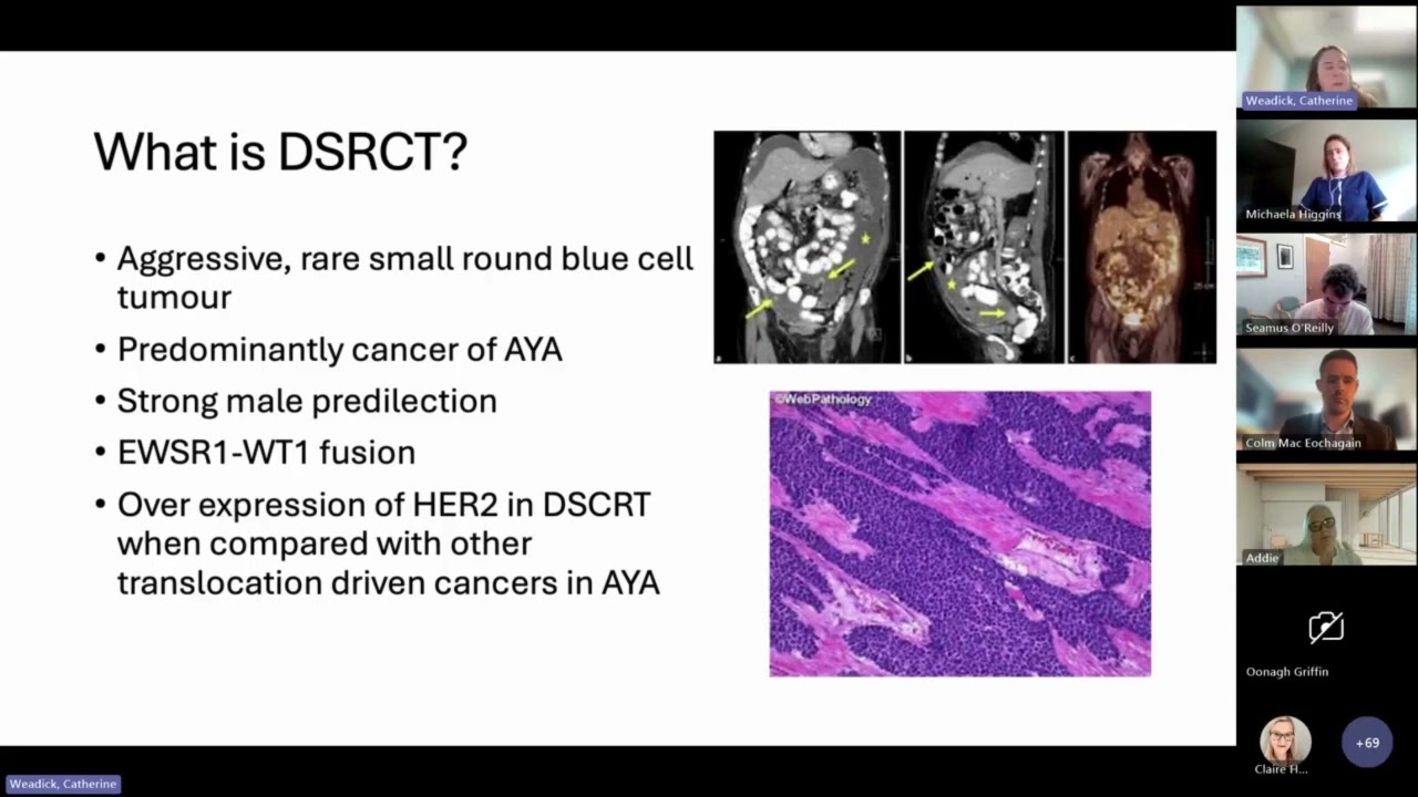 ISMO AFTER ASCO 2025 –Event Recording