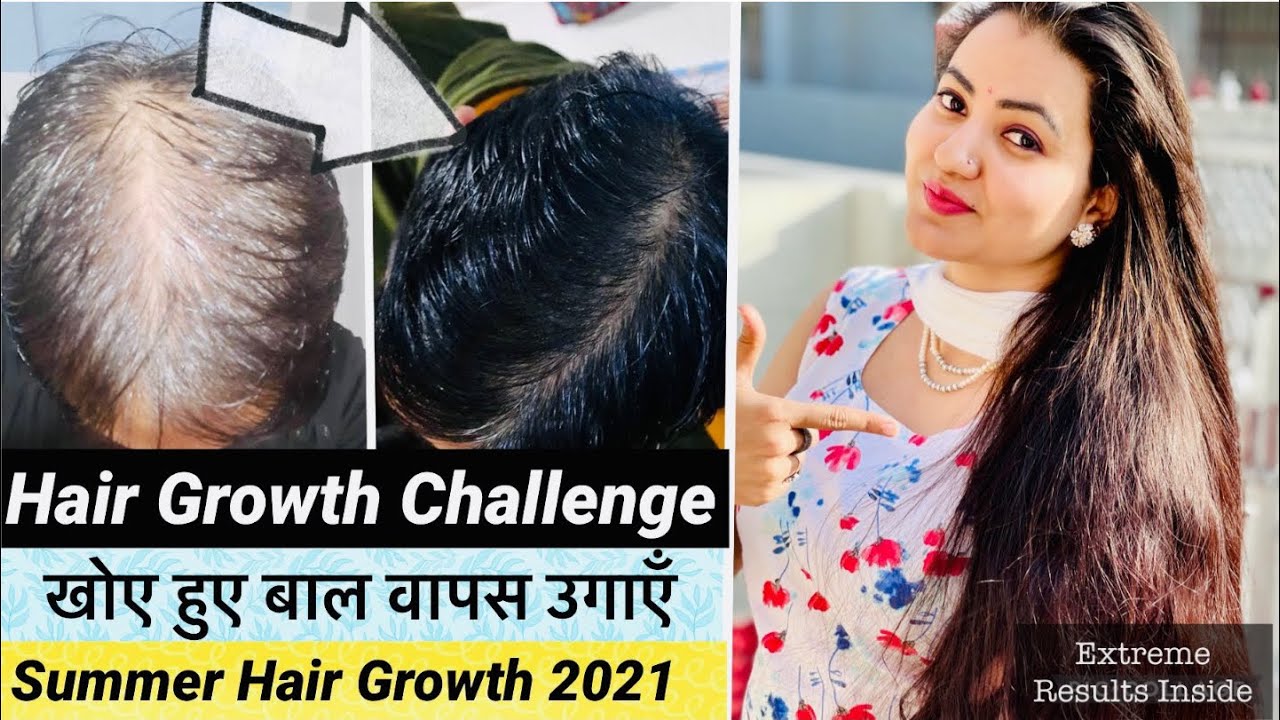 Summer Hair Growth Transformation Challenge To Regrow Lost Hair|खोये हुए बाल वापस उगाने का अचूक उपाय