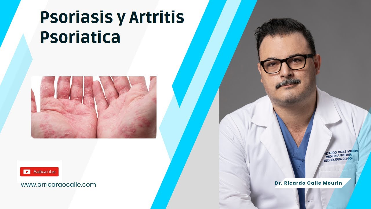 Psoriasis y Artritis Psoriasica | Características, Síntomas y Complicaciones