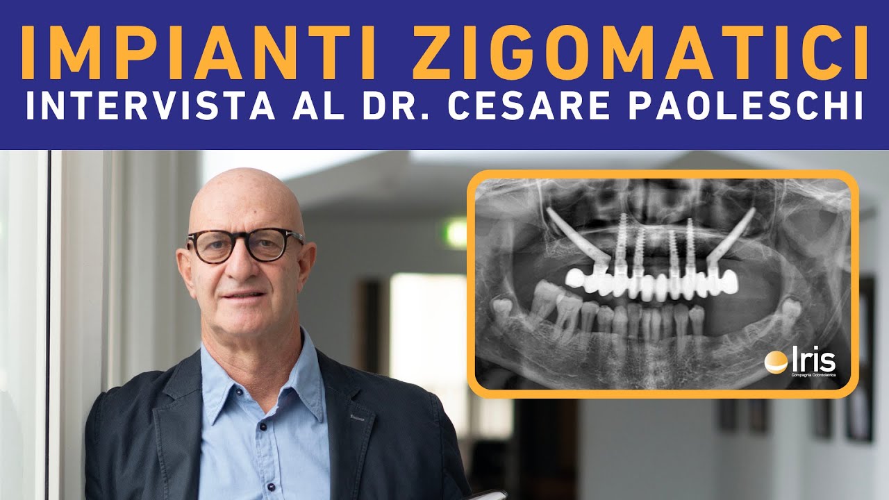 Scopri l' innovativa tecnica degli IMPIANTI ZIGOMATICI con il Dott. Cesare Paoleschi