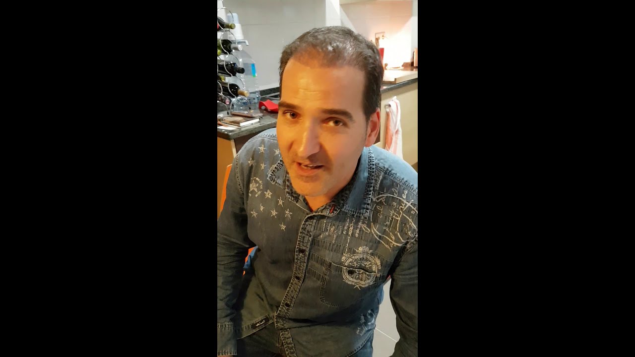 Injerto Capilar 4 meses y dos semanas