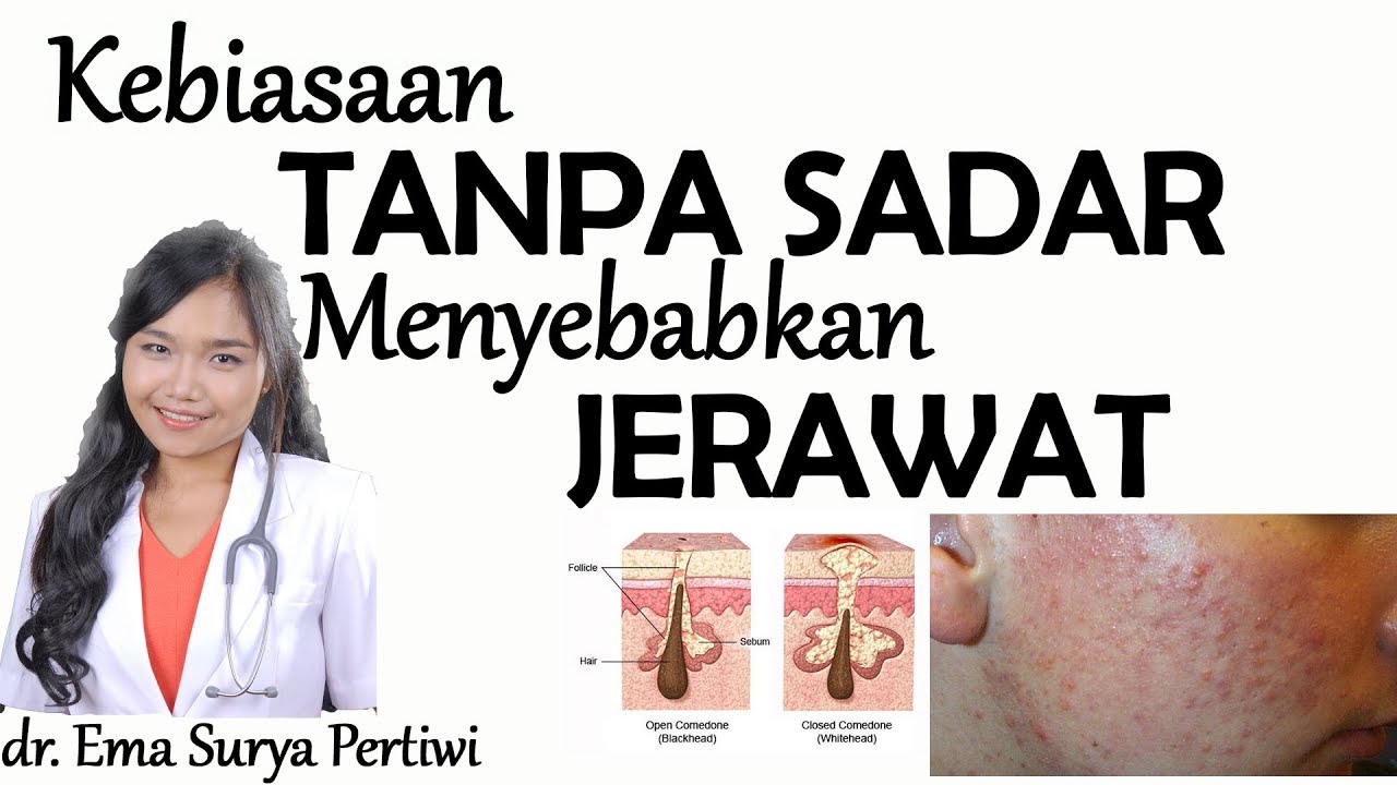 Kebiasaan Bikin Jerawat SULIT HILANG  #acne1 | dr. Ema Surya P