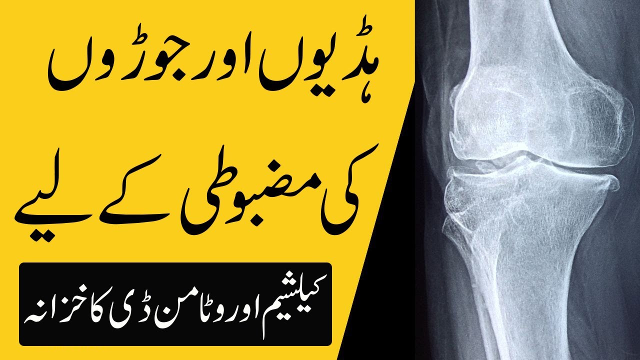 Hadion Aur Joron ki Kamzori ka ilaj | Calcium ki kami ka ilaj | Vitamin D Deficiency Treatment
