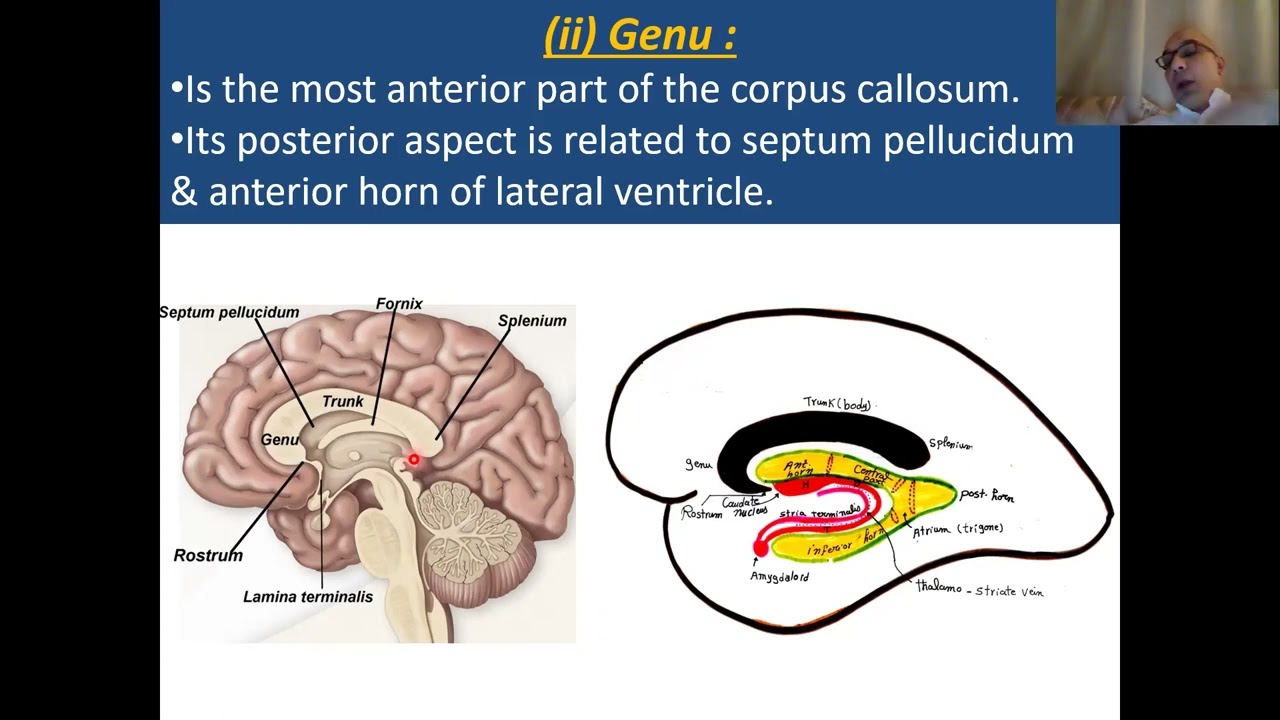 Commissural fibres & corpus callosum