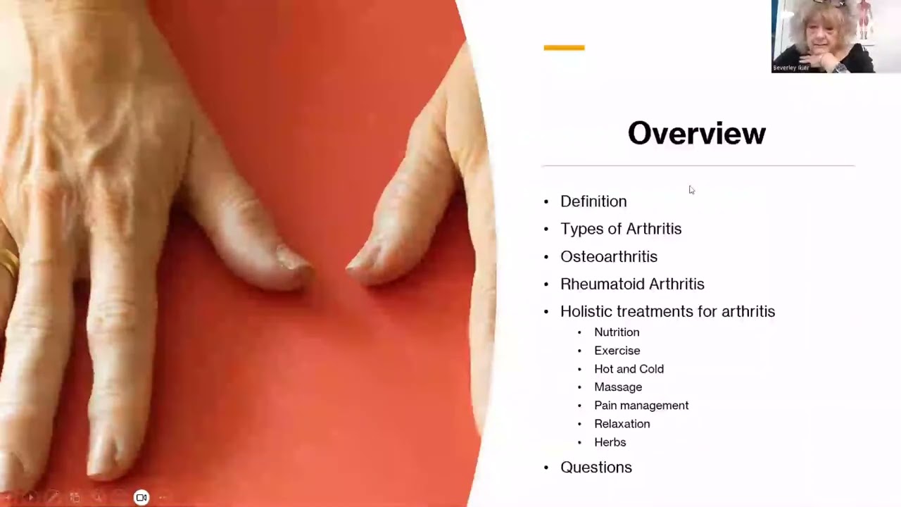 Arthritis Overview