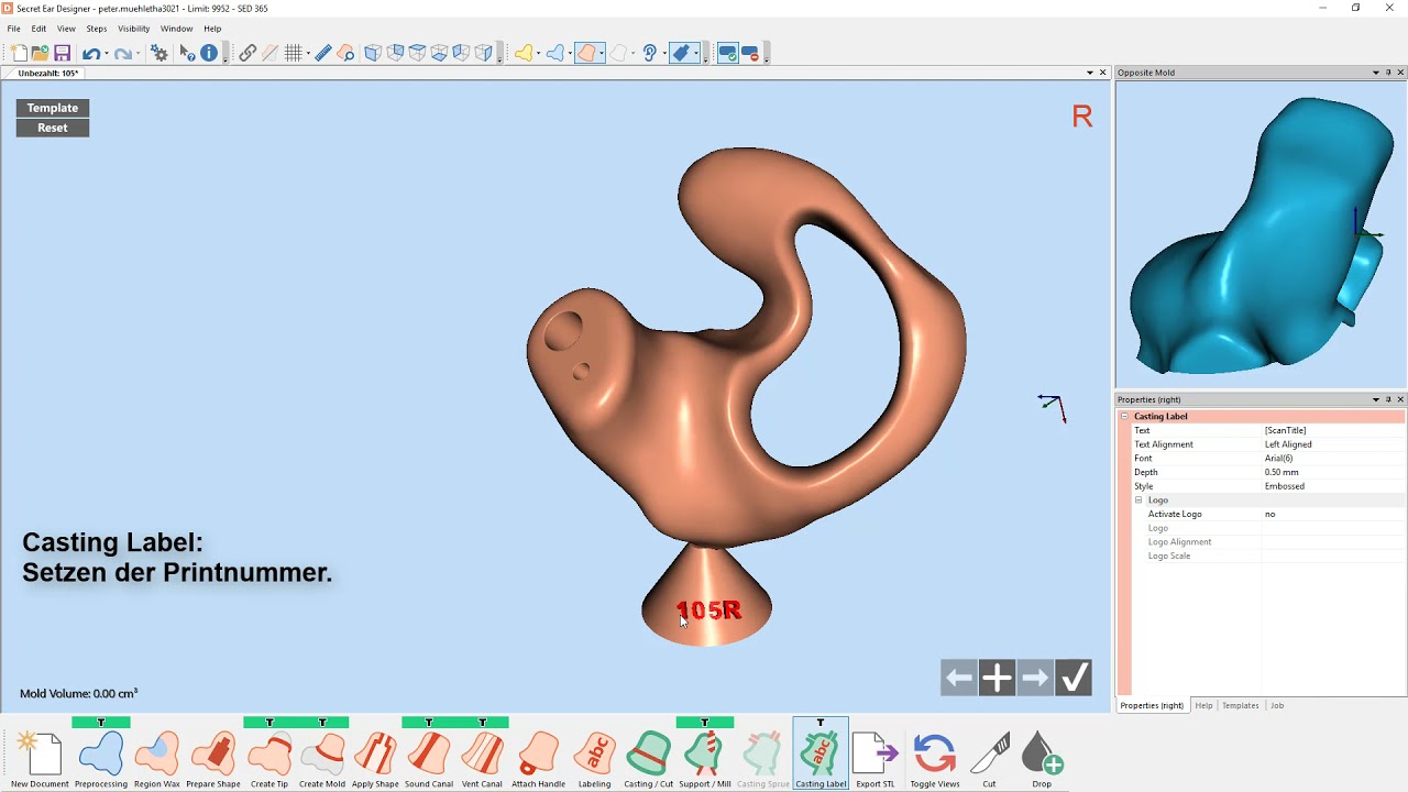 Modellieren von HdO-Otoplastiken im Secret Ear Designer