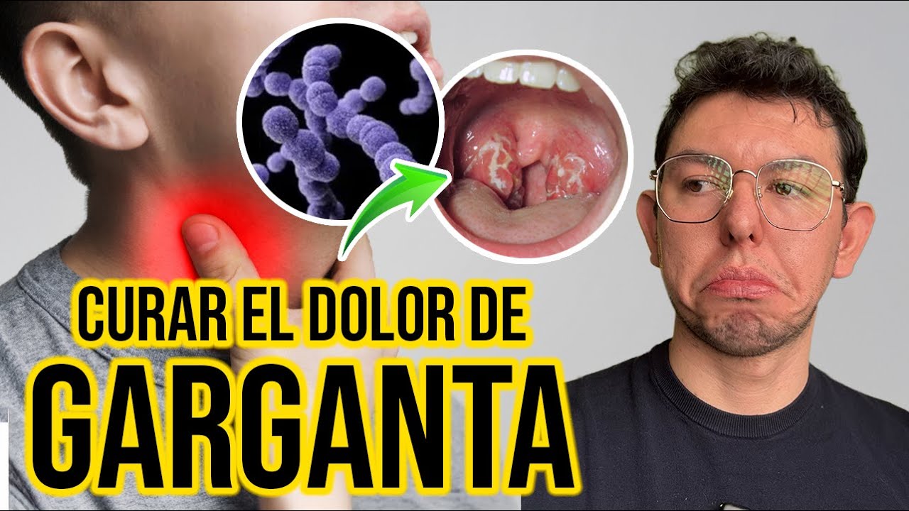 ASÍ es como SE TRATA un DOLOR DE GARGANTA | DrPoloGuerrero