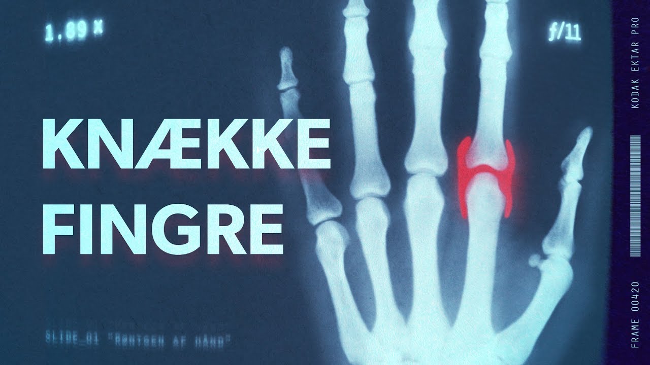 Får du gigt af at knække fingre?