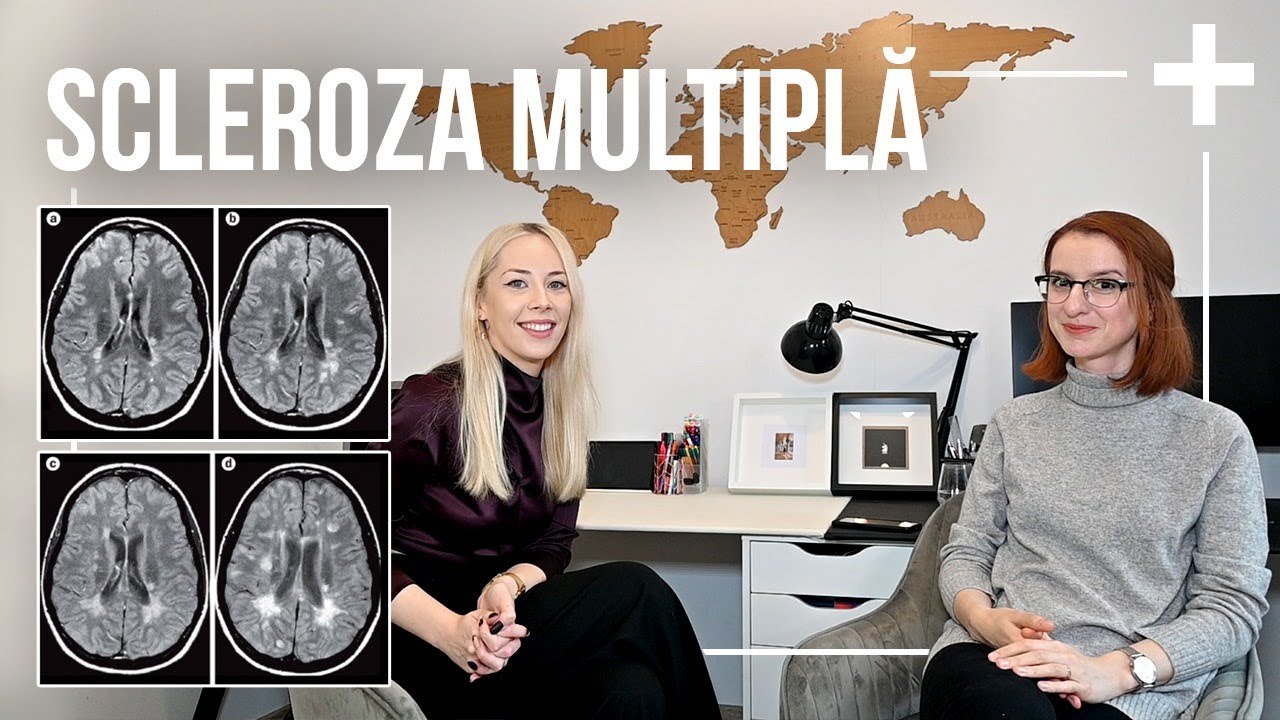 Despre Scleroza Multipla impreuna cu Dr. Silvia Patrasc