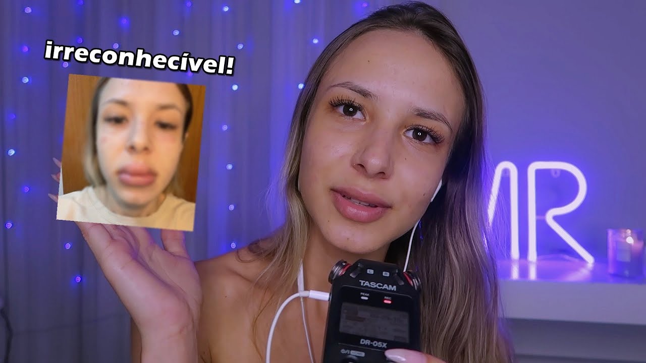 ASMR - PRECISAMOS CONVERSAR..! O que aconteceu com meu rosto? Estou proibida de usar maquiagem?!