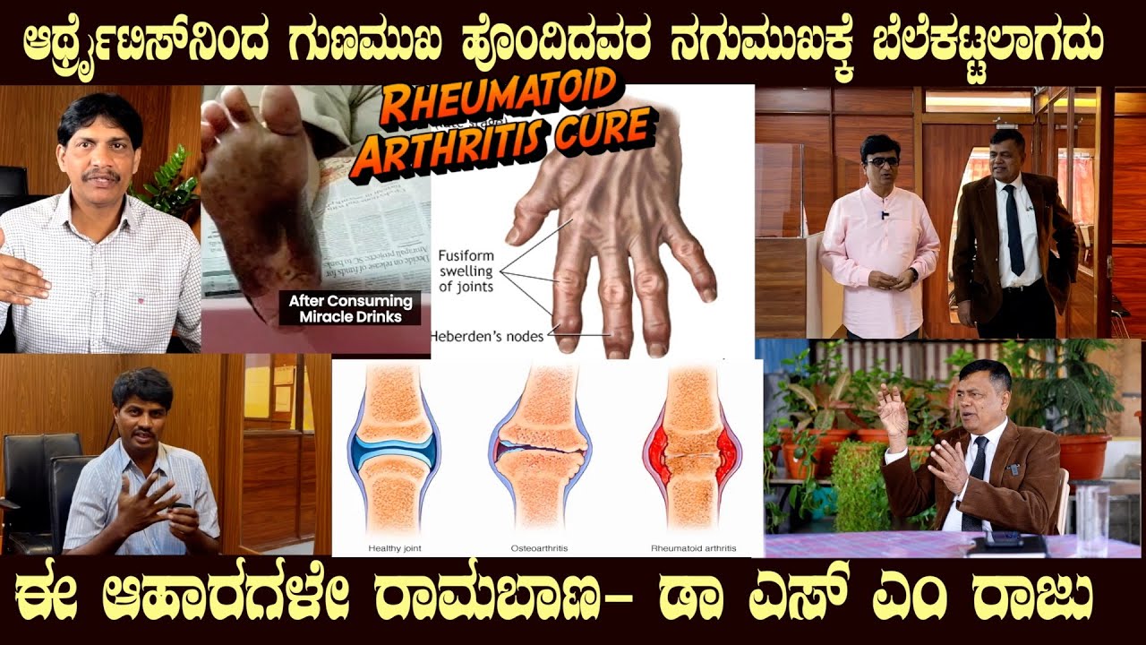 Rheumatoid ARTHRITIS Cured by Dr SM Raju IAS (Rtd) Soaked Ground nuts effectiveness explained