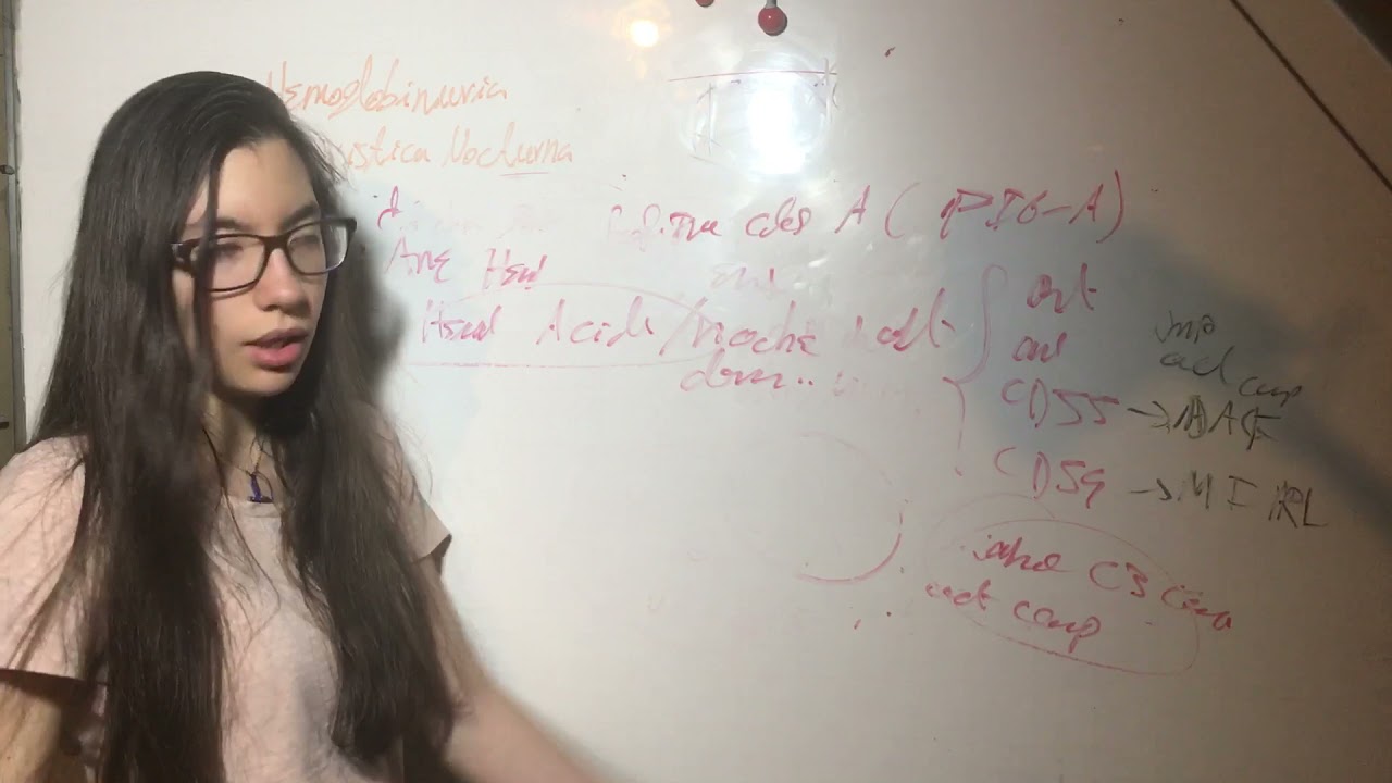 Versión Corta Hemoglobinuria Paroxistica Nocturna:Patofisiologia/Cuadro Clinico/Complicaciones/Dx/Tx