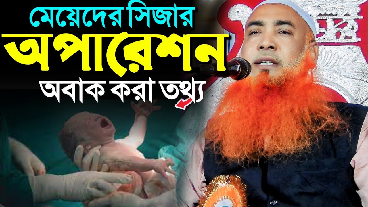 সিজার অপারেশন নিয়ে অবাক করা তথ্য┇মাওঃ আবু ওবায়দা সাহেব┇Abu Obaida Chaturvedi waz┇Abu Obaida waz