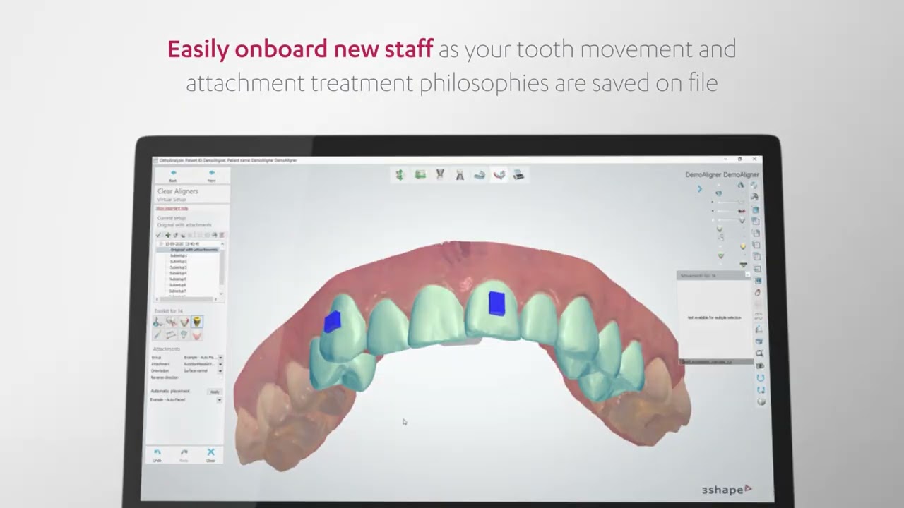 3Shape Clear Aligner Studio Product Video 2021