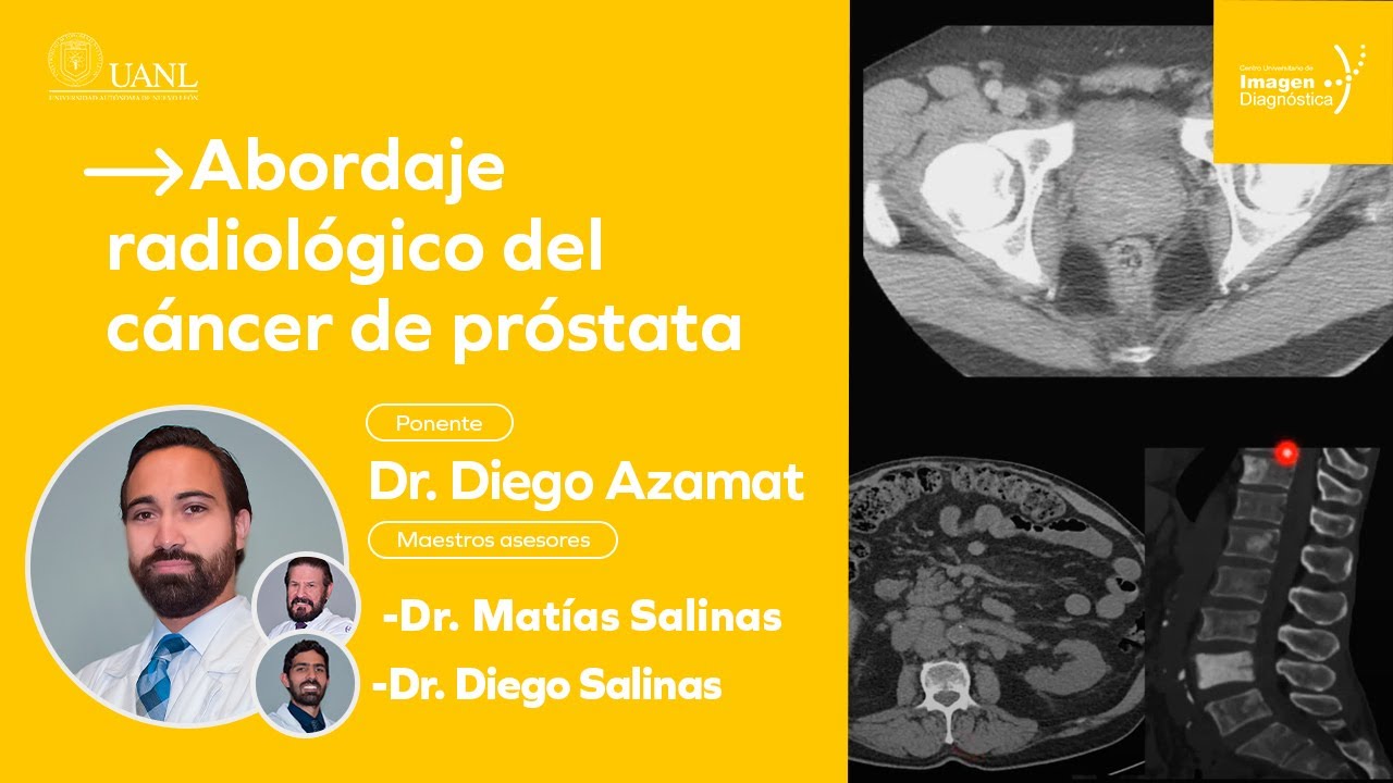 Abordaje radiológico del cáncer de próstata por el Dr. Diego Azamat