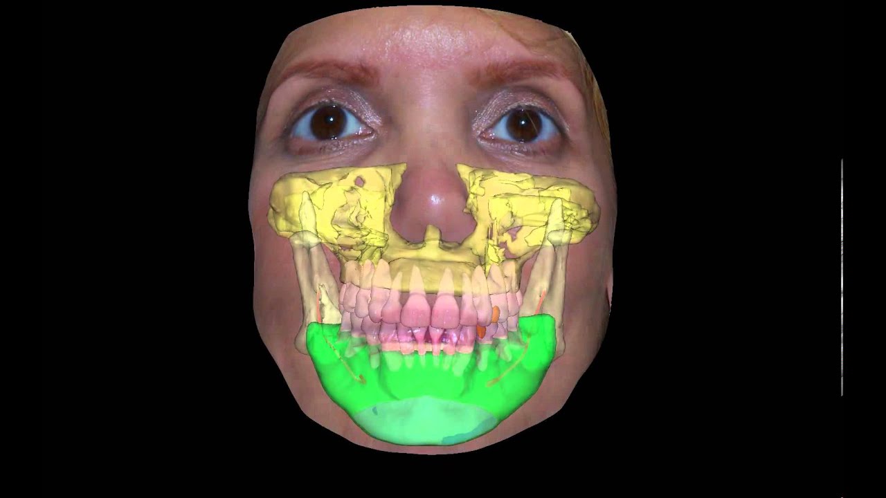 Computerized Orthodontic Treatment Planning