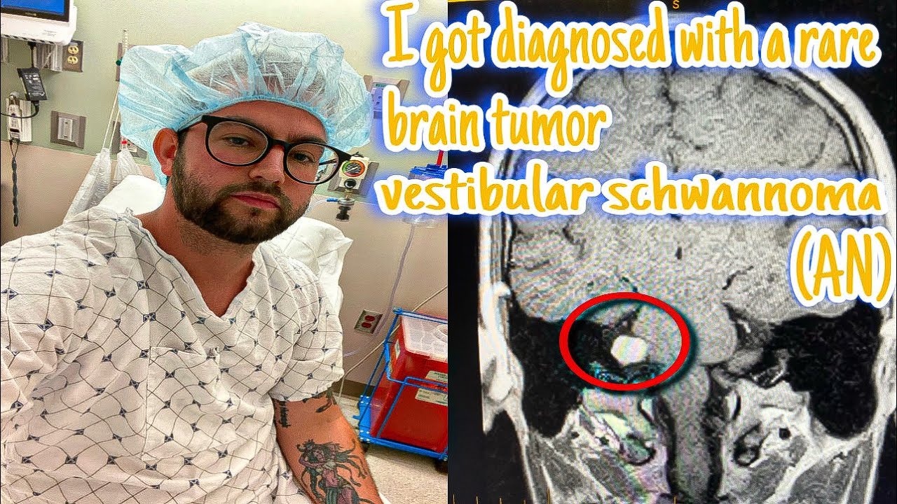 Brain tumor at 26 years old. Here’s my story