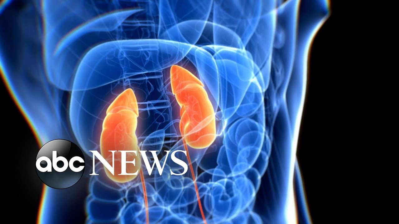 Doctors trying to understand COVID-19 symptoms left with more questions