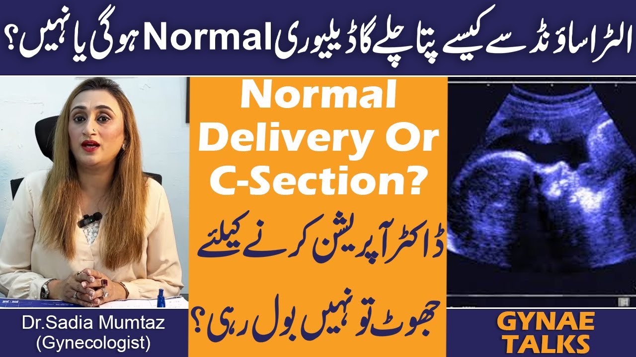 Ultra Sound Se Kaise PTa Chale Ga Delivery Normal Hogi Ya Nahi? Normal Delivery Or C Section?