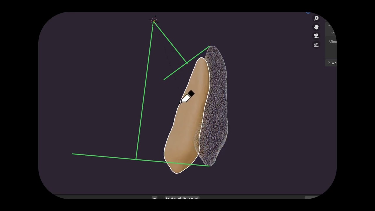 Center of rotation or Center of resistance in Orthodontic Tooth Movement