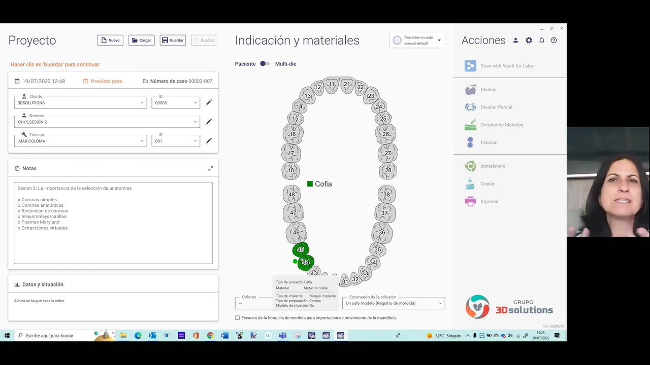 Curso Online Exocad de la A a la Z