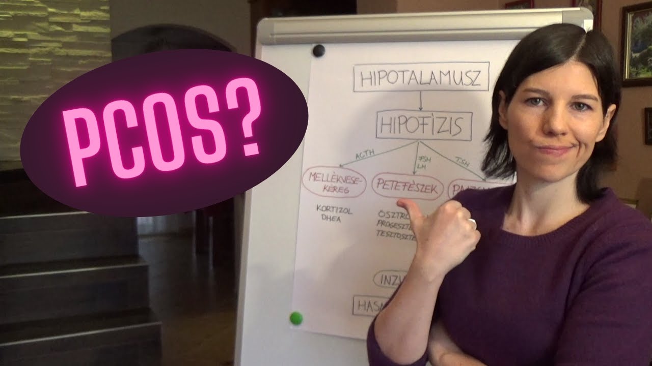PCOS – a túldiagnosztizált tünetegyüttes
