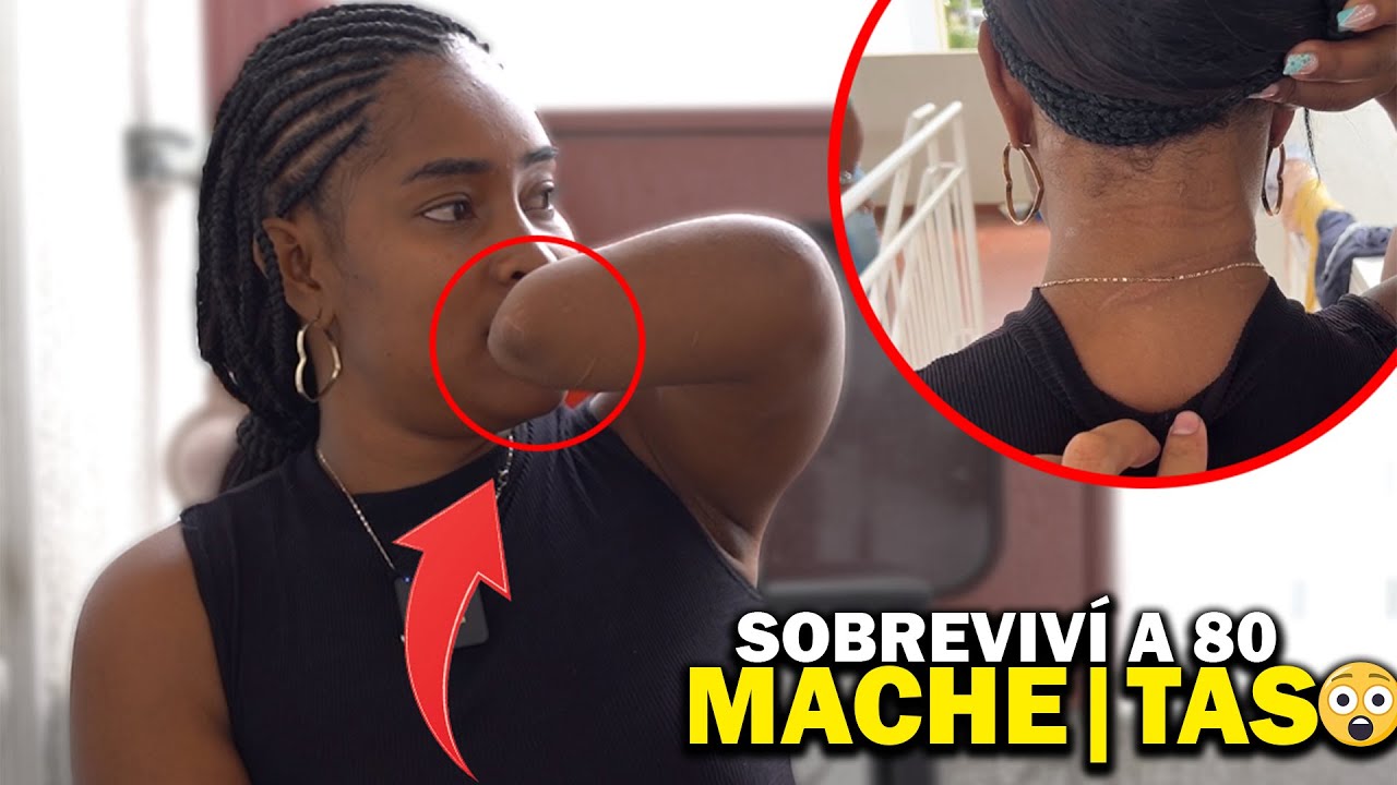 ELLA SOBREVIVIÓ A 86 MACHE|TAS0S😨😪  POR GRUPOS AL MARGEN