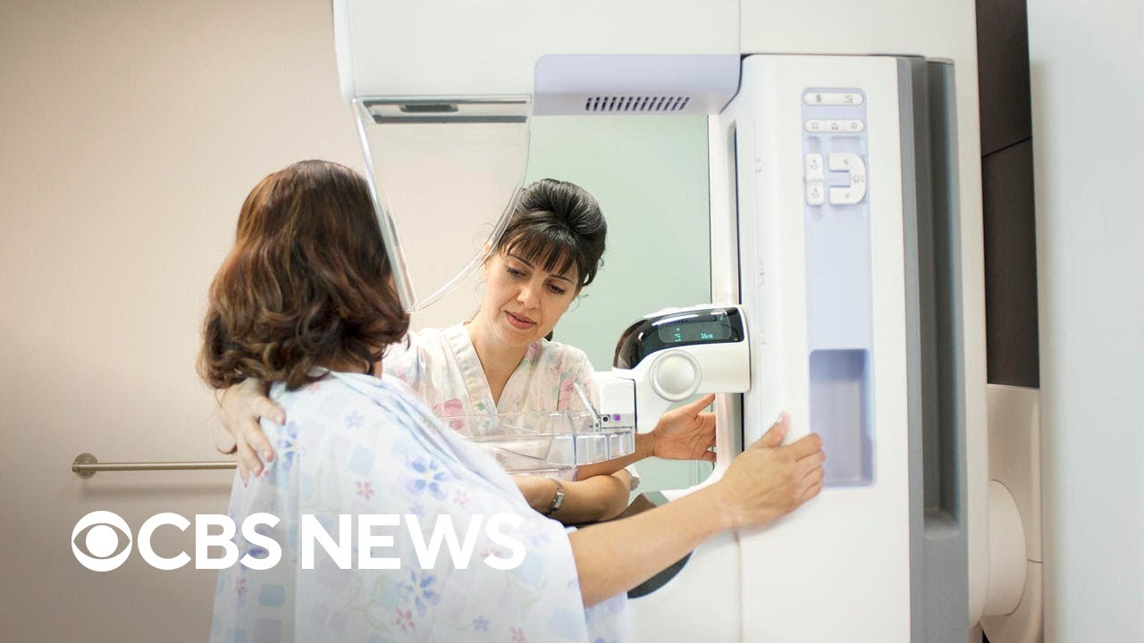 What to know about new breast cancer screening guidelines