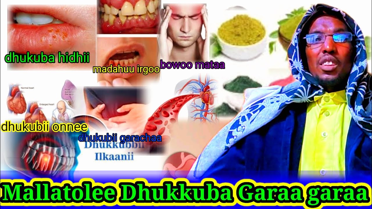🛑Qoricha Barbadian Argachuuf Mallatole Dhukuba Himachuun Sheek Bayaan Qunnamaa