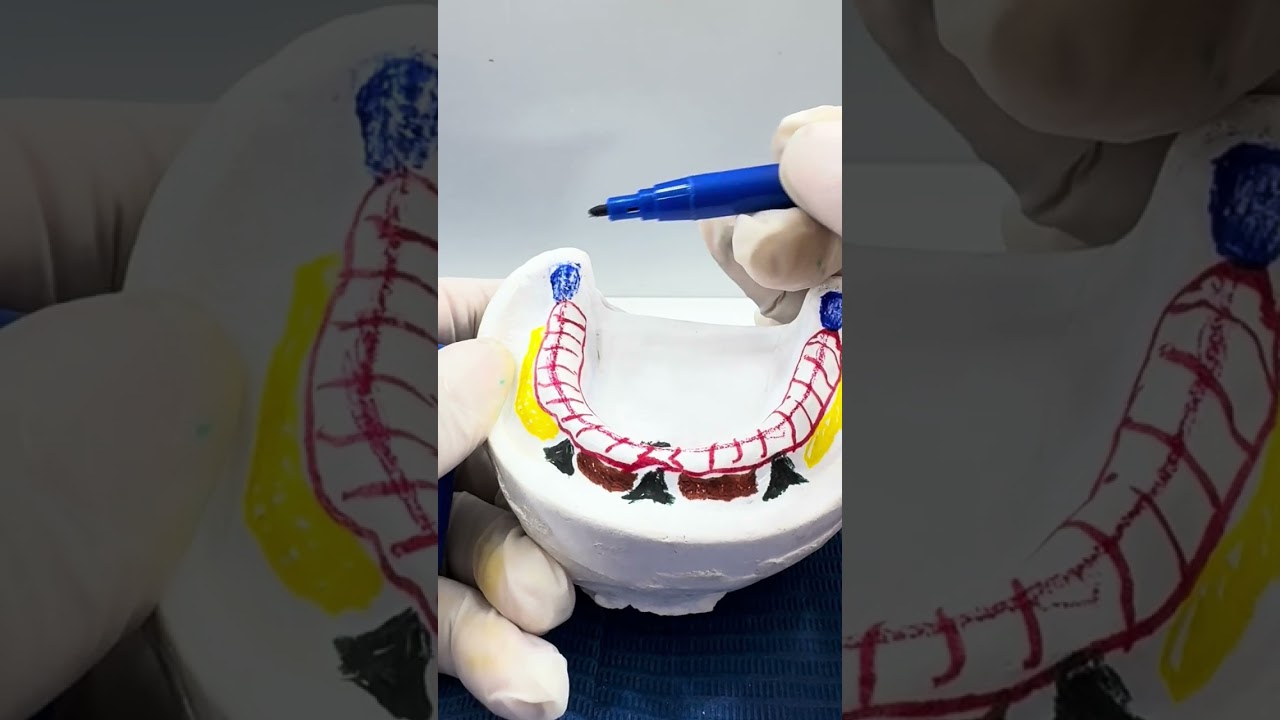 Anatomía de la arcada inferior del desdentado 