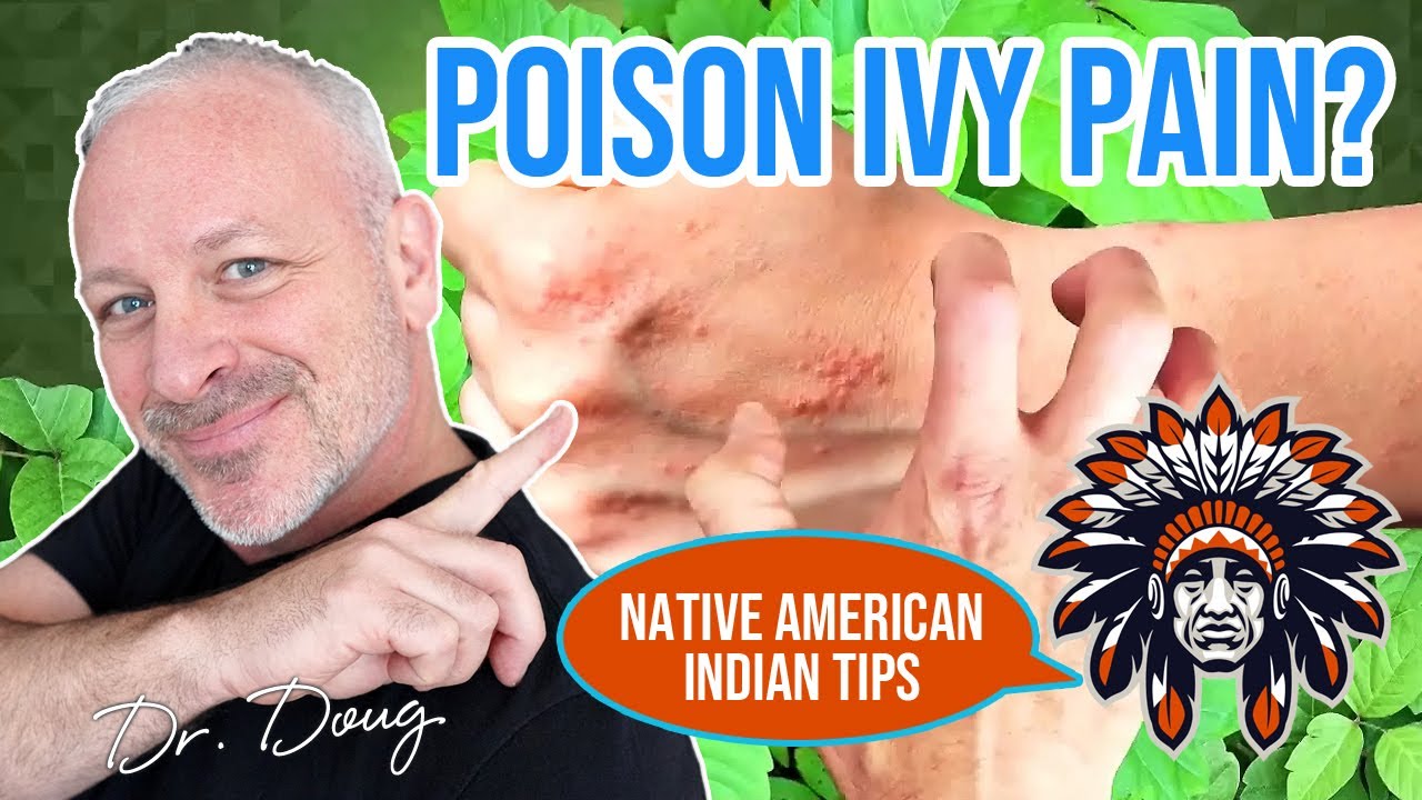 POISON IVY: Native American Indian Tips!