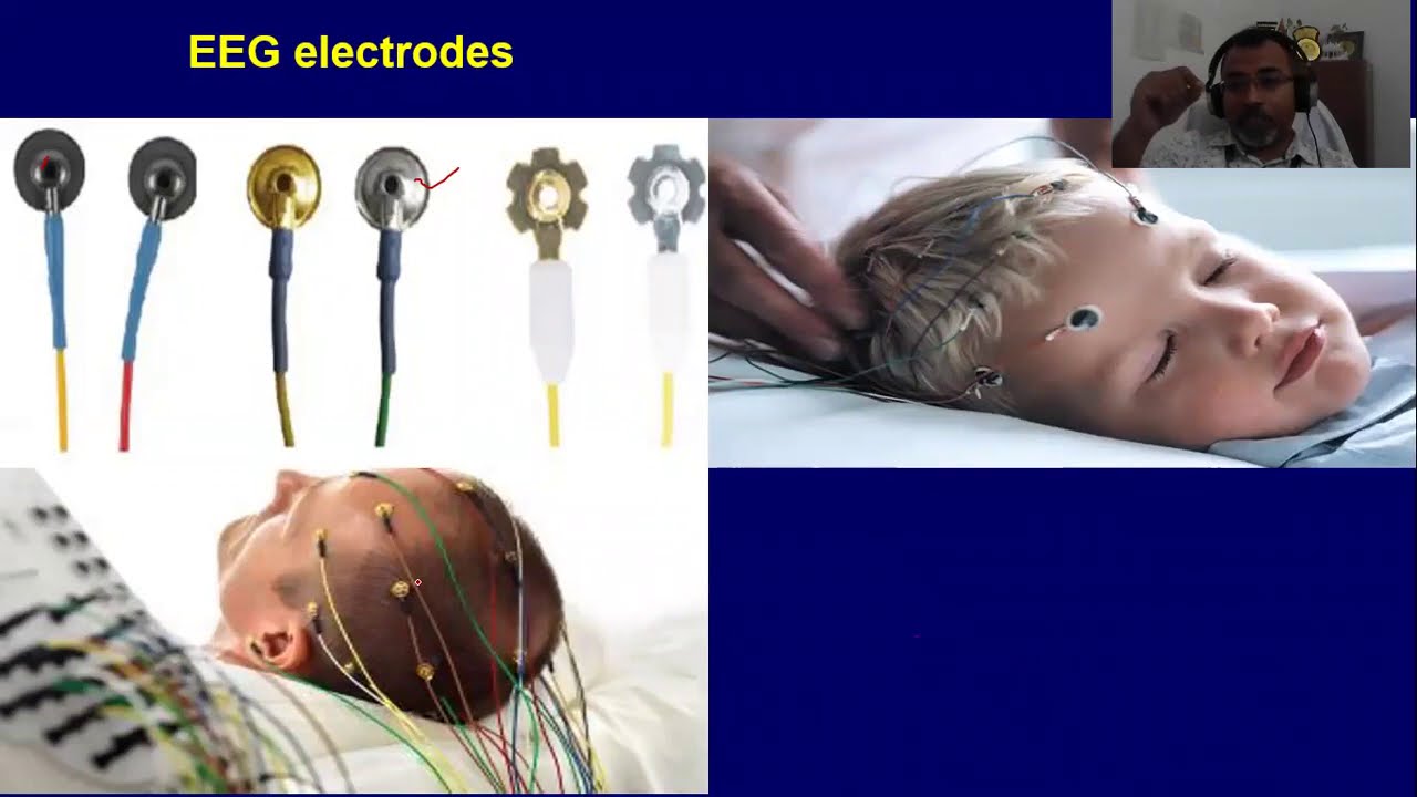 EEG: 3 (EEG electrode placements, EEG waves)