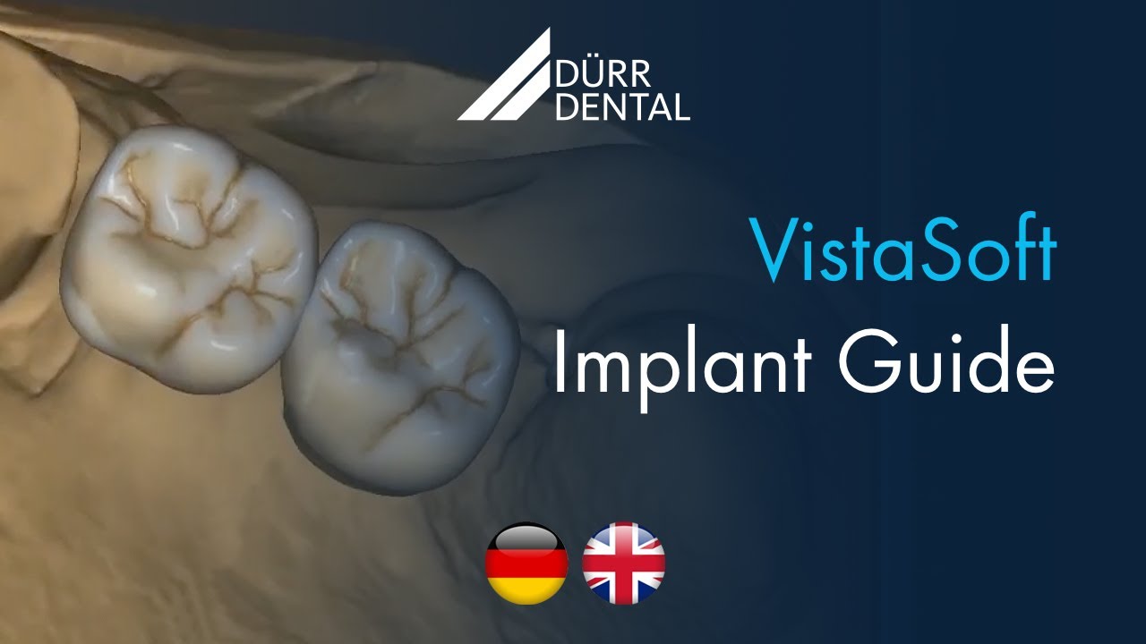 VistaSoft Implant & Guide