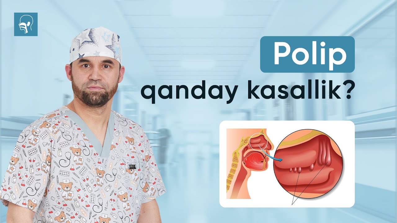 Polip qanday kasallik? | Dr Asqar Ashurov