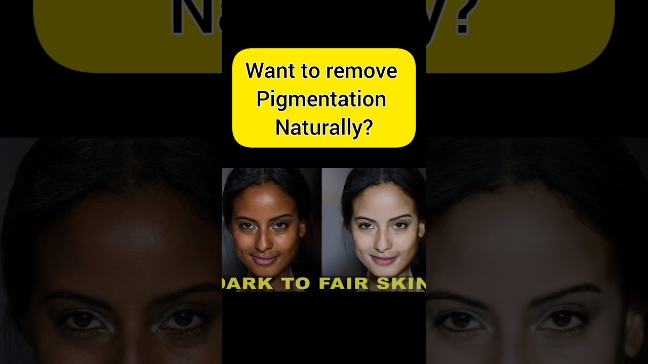 Pigmentation kaise Hataye | Pigmentation kam kaise kare