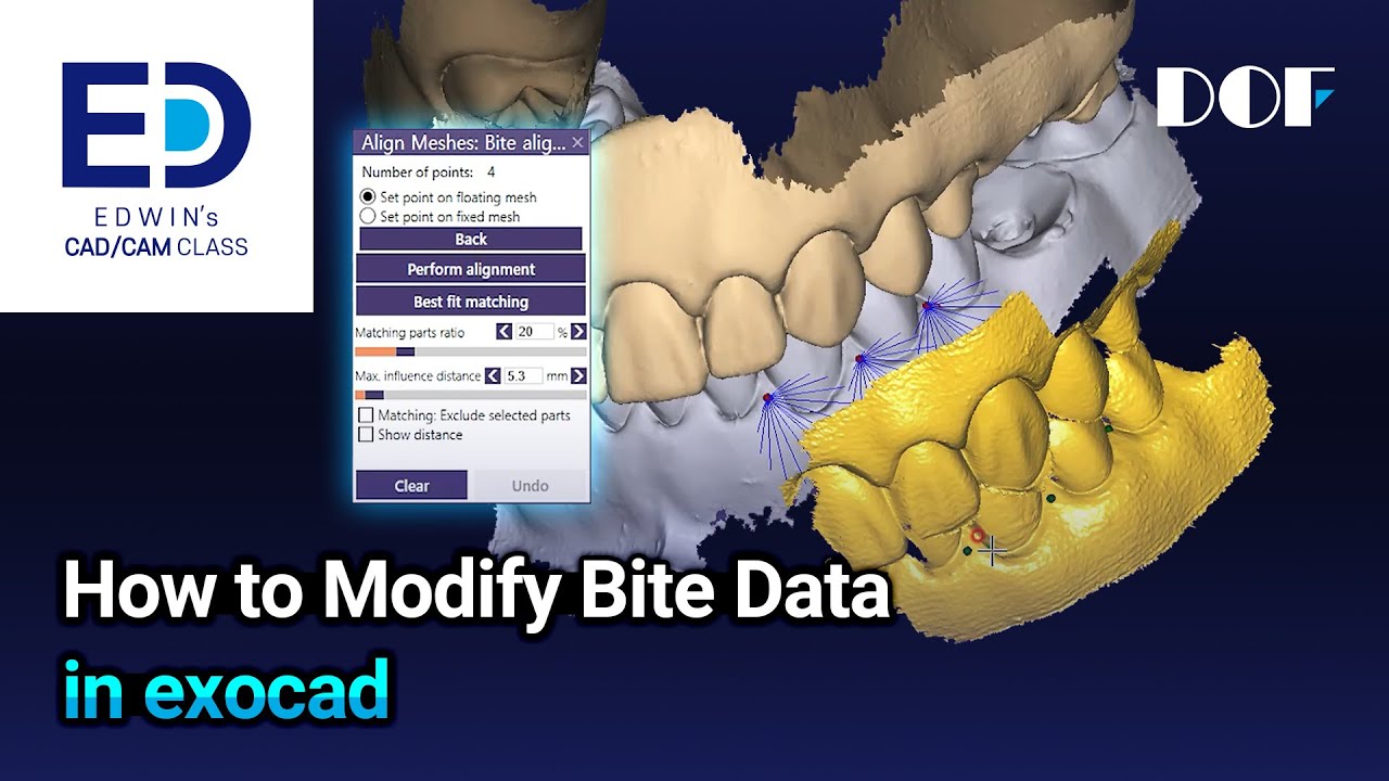 How to Modify Bite Data in exocad