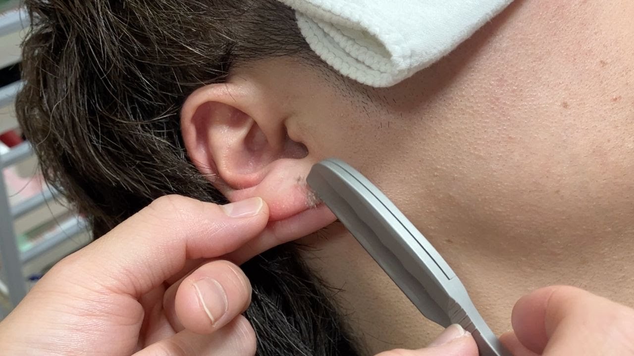 【疲れた夜に…ぐっすり眠れる耳かき】耳毛もしっかり剃ってから気持ちい耳掃除が最高