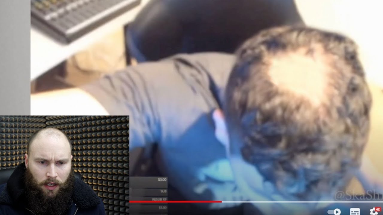The Moment You Find Out You're Going Bald
