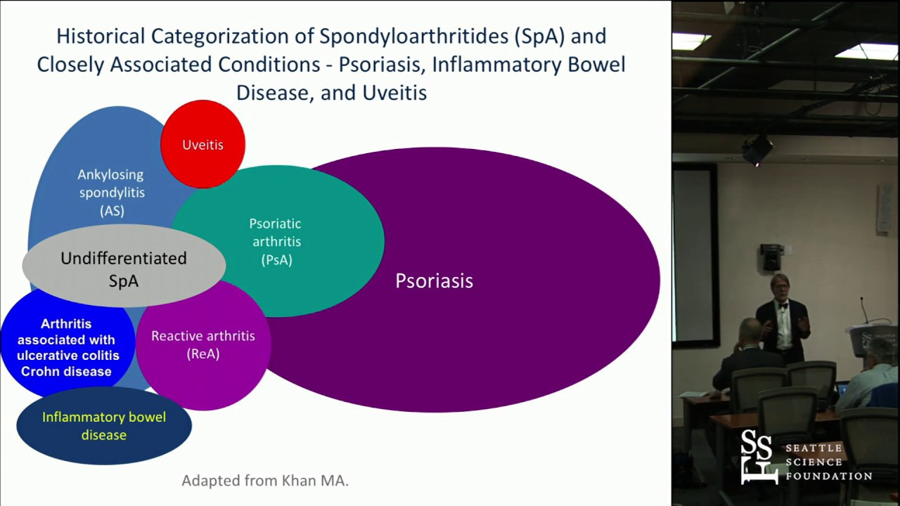 Spondyloarthritis: Where are we in 2018 - Philip Mease, MD