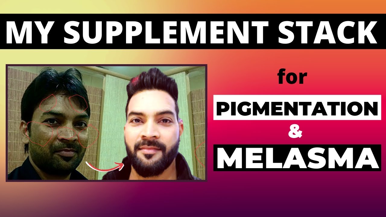My supplement stack for Pigmentation & Melasma