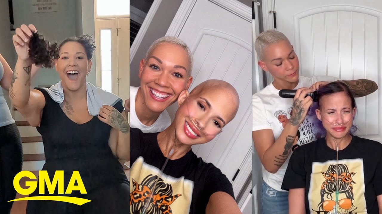 Friends shave each other’s heads after cancer, female pattern baldness
