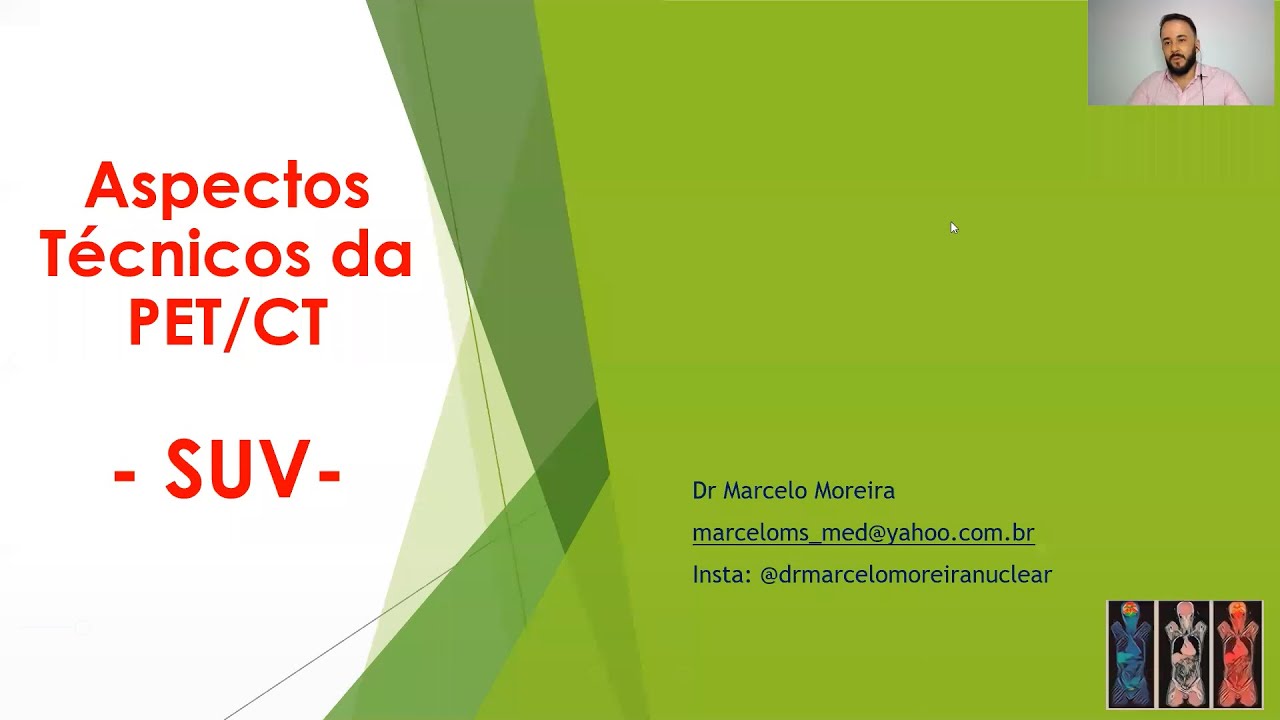 SUV - Aspecto Técnicos