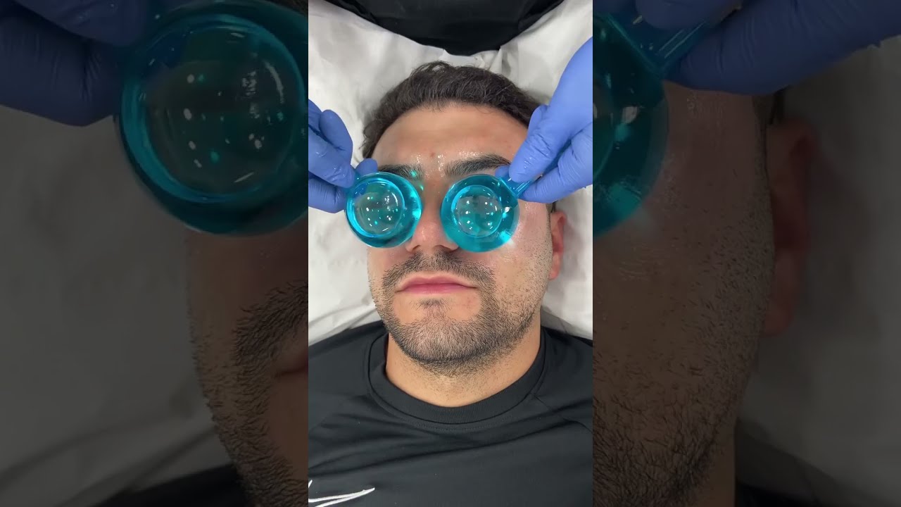 Relaxing facial ice globes | Dr. Medispa
