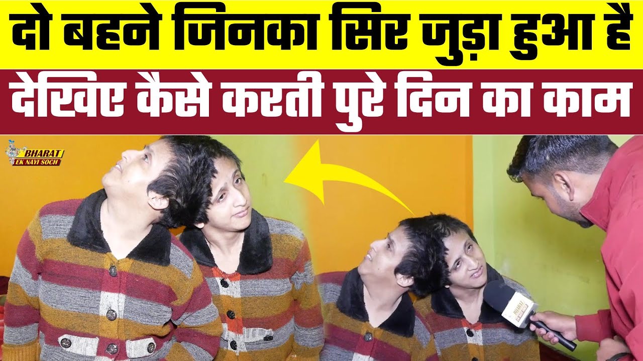 दो बहने जिनका सिर जुड़ा हुआ है देखिए कैसे करती पुरे दिन का काम, Bharat Ek Nayi Soch