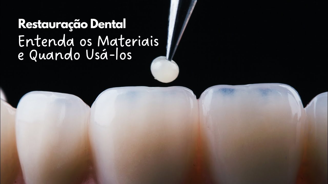 Restauração Dental: Entenda os Materiais e Quando Usá-los | Dra Andressa Mezzomo
